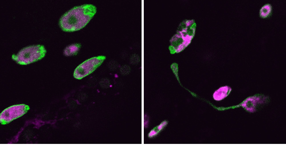 Un estudio del CABD arroja luz sobre la progeria, una enfermedad rara que acelera el envejecimiento prematuro